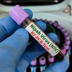 nipahvirus