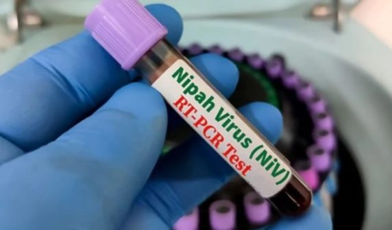 nipahvirus