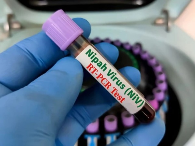 nipahvirus