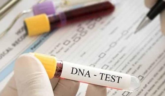 dna match defence case